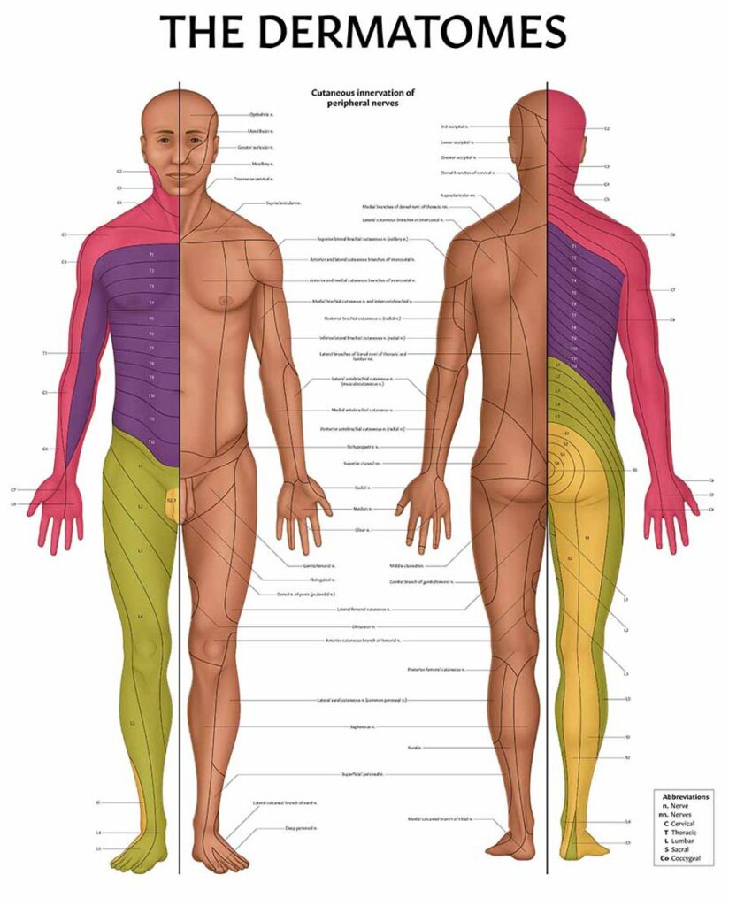 Printable Shingles Dermatome Map Printable Jd