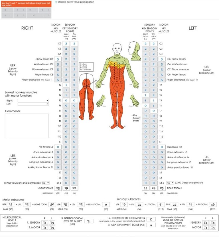 Printable Spinal Cord Assessment And Dermatone Printable Jd