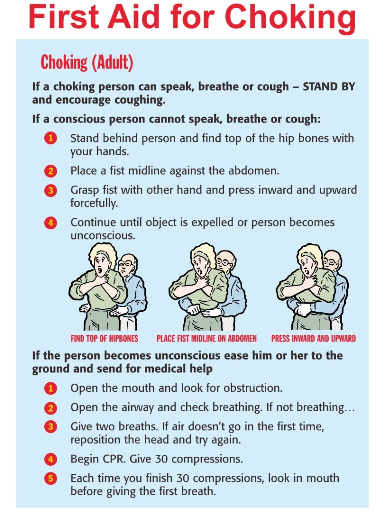 Printable First Aid Choking Poster - Printable JD