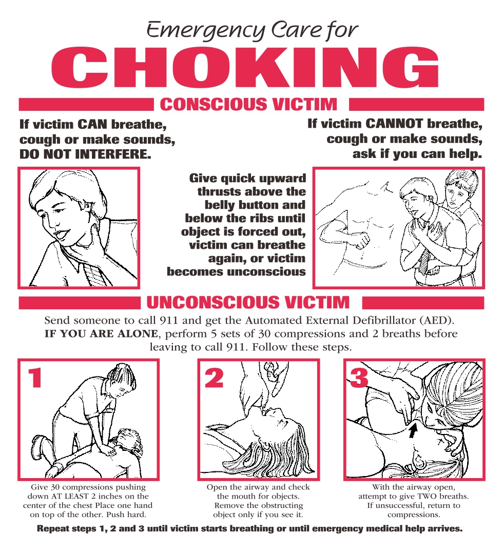 Printable First Aid Choking Poster_52184
