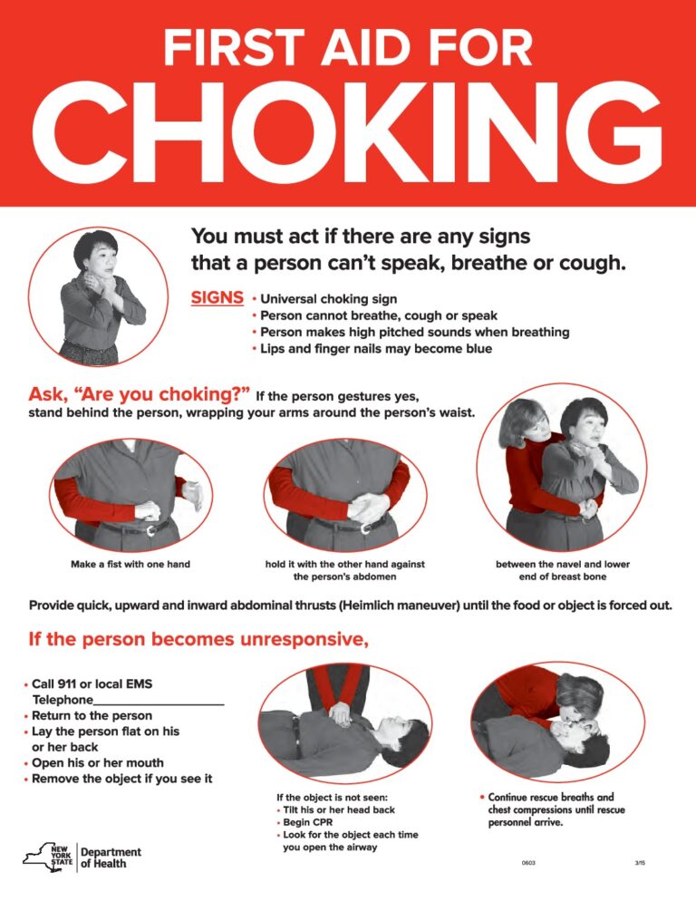 Printable First Aid Choking Poster Printable JD