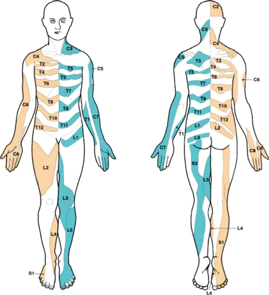 Printable Arm Dermatome Printable Jd