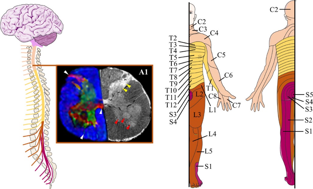 Printable Arm Dermatome_62511