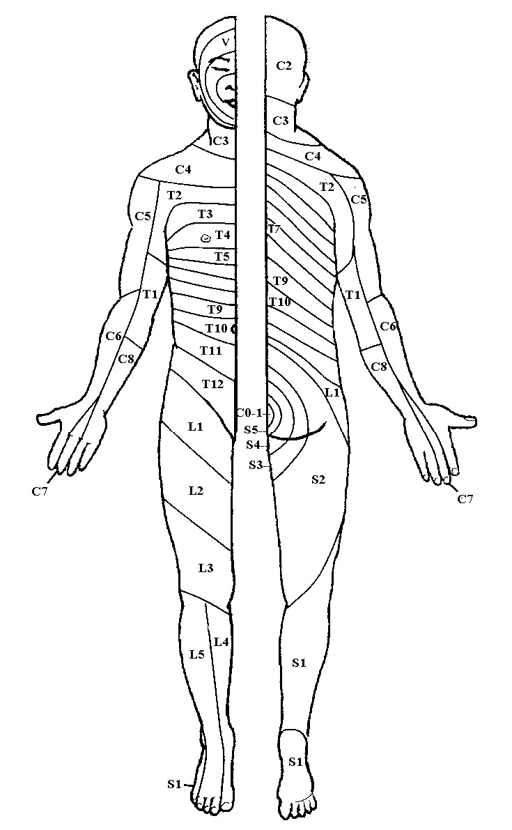 Printable Cervical Dermatomes - Printable JD