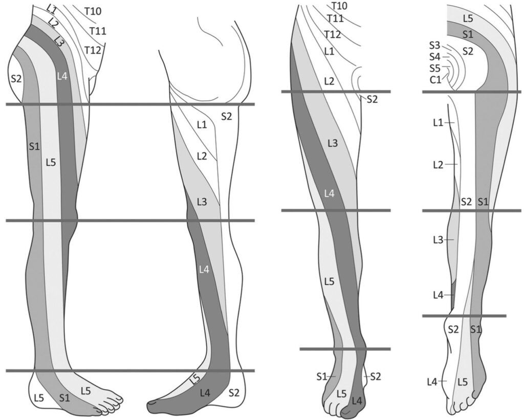 Printable Leg Dermatomes - Printable JD