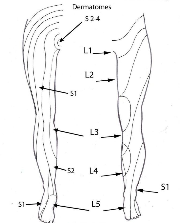 Printable Leg Dermatomes Printable Jd