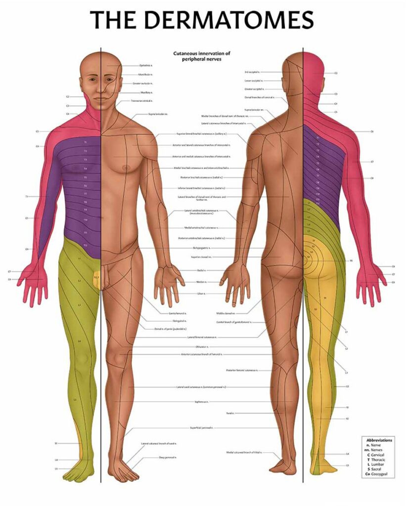 Printable Lumbar Dermatomes Printable Jd