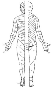 Printable Shingles Dermatome Map - Printable JD