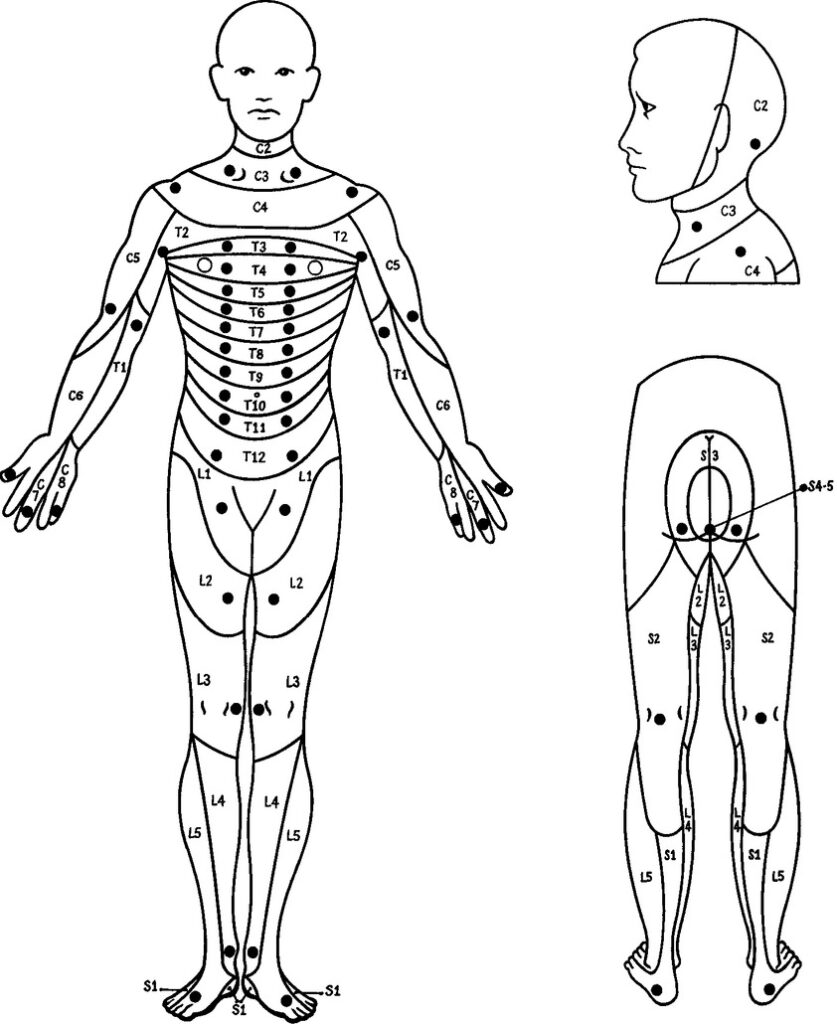 Printable Spinal Cord Assessment and Dermatone - Printable JD