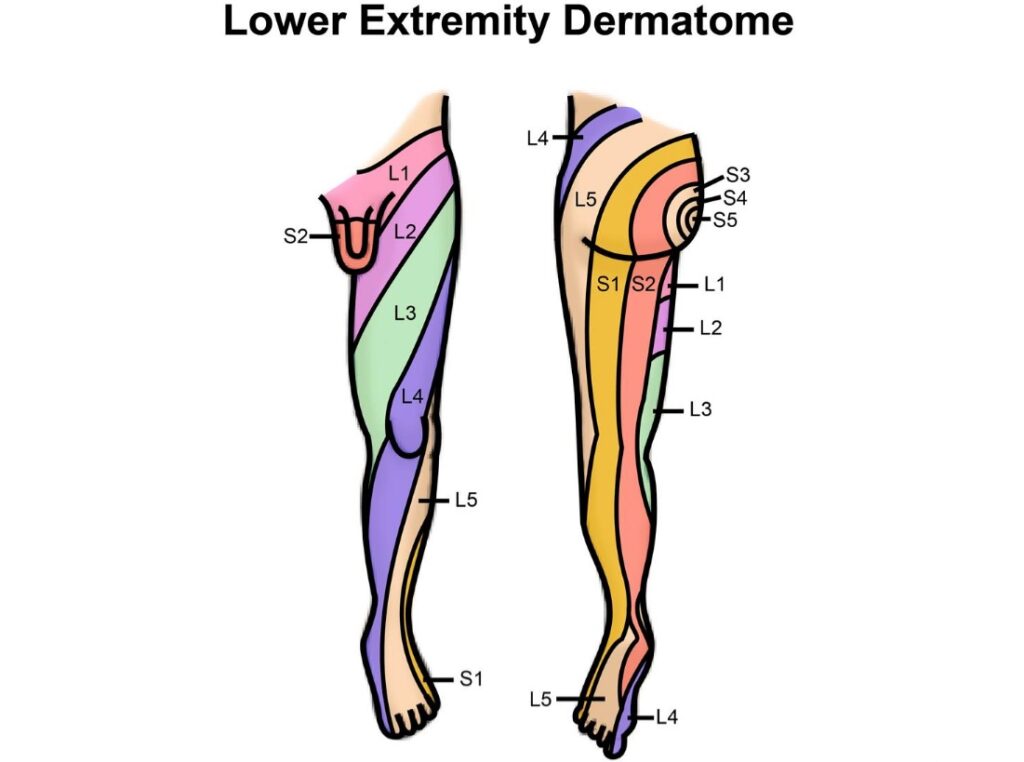 Printable Upper Limb Dermatomes - Printable Jd