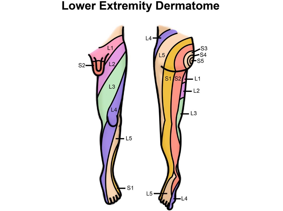 Printable Upper Limb Dermatomes_95821